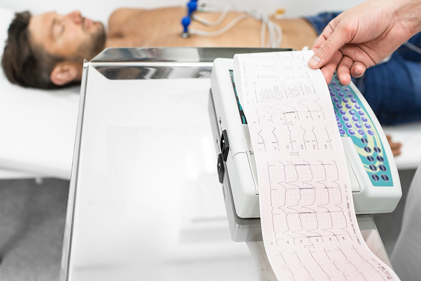 Esame elettrocardiogramma (ECG)